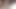 長い暗い毛むくじゃらの脇の下のクローズアップ
