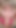ペニススラット服従訓練療法