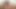 Lizzy Yum August 2022 #6 clitoral post op masturbation multiple orgasm The 35 minute Lizzy Yum Clitoral Workout #2