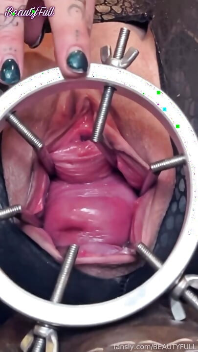 Arătându-mi colul uterin pompat