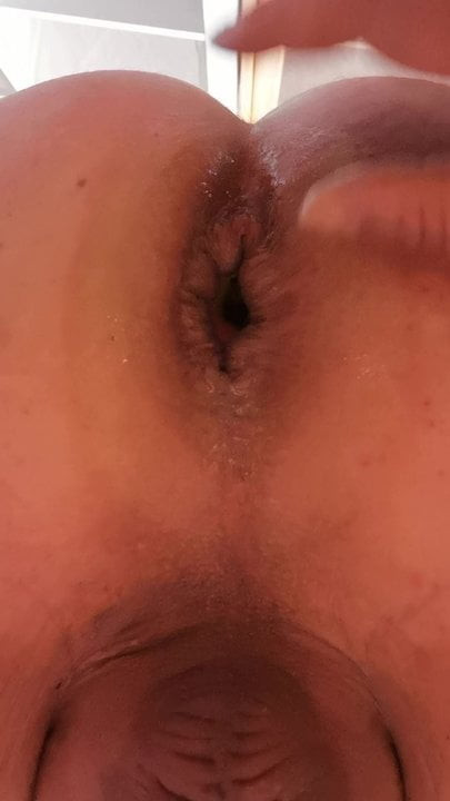 Appel