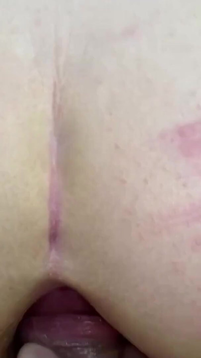 Outdoor hardcore anal Cumshot. Public Blowjob. Ass destroy. | Clip 1