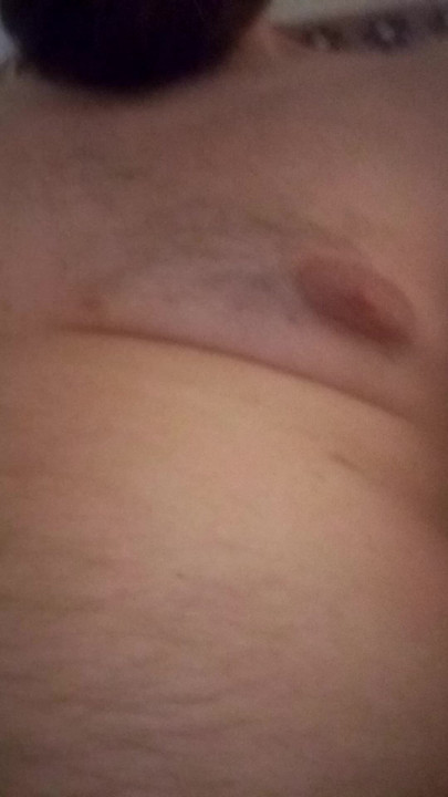 Nipples