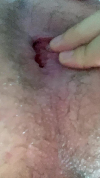 Gay teen asshole play