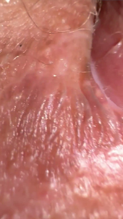 18 y.o. girl says: Why you put camera in my butthole? You want to see there bird? | Clip 1