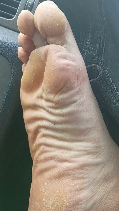 Dirty feet