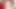 ルミの口の中:彼女の歯科治療の秘密を探る!