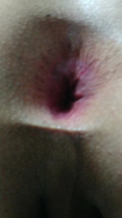 Asshole closeup