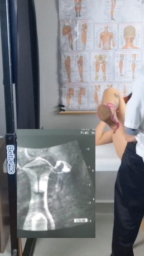 Cuckolden, kona og den frekke gynekologen under ultralyden! | klipp 1