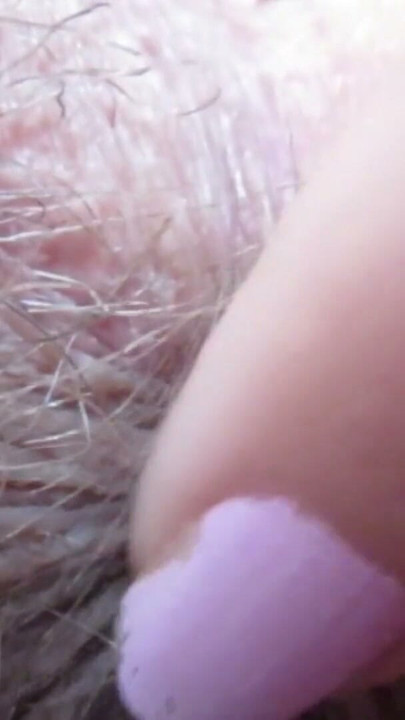Asshole exteme closeup ass fetish anal | Clip 1