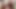 きついからゆっくりとやるように言われる