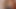 おっぱいの仕事後の最初のシャワー - 排出、腫れ、あざ