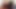 指の隙間アス