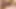 Pussy Pump Gives 18 Year Old Huge Cunt Lips