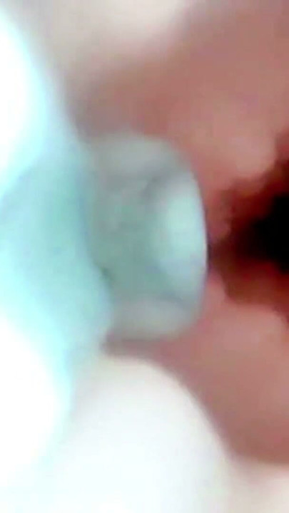 A detailed examination of Lopuza93 oral cavity and anal area using an endoscope camera. | Clip 1