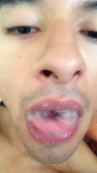 Swallowing straight loads