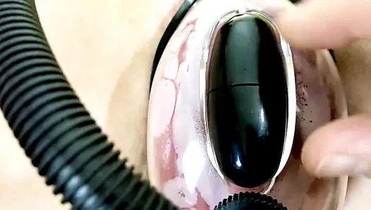 Vaginal Deformation Under the Influence of a Vacuum Pump