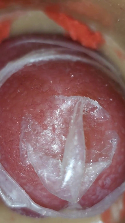 زيادة لا يمكن السيطرة عليها تملأ الكس بضغط داخلي لا نهاية له