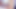 Interracial Anal: 30cm Black Cock in Tight White Ass - Extreme Contrasts