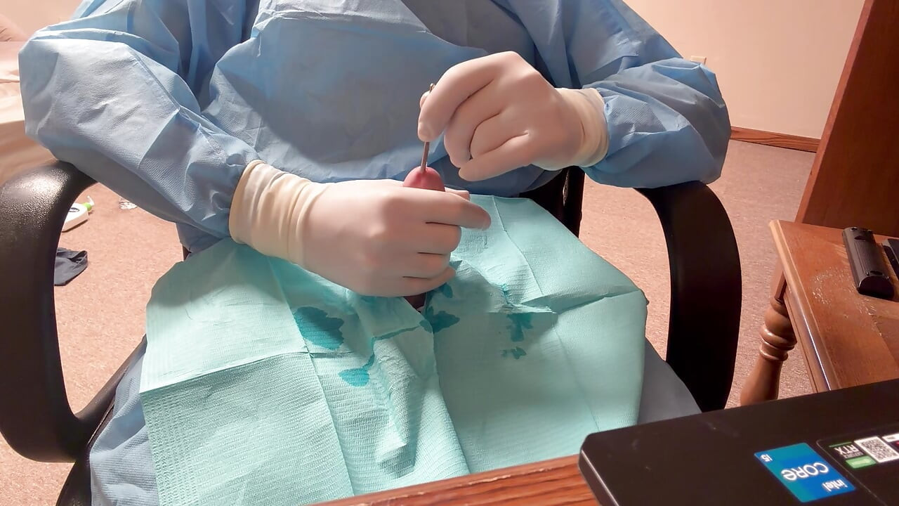 Surgical Latex Glove Sounding and Cumming