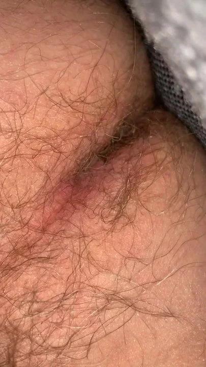 Asshole