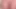 Handsome with hairy cyst closeup
