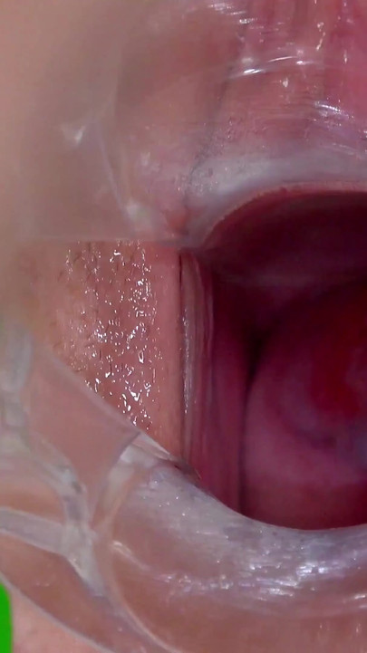 Silicone Sex Bomb Gets Treatment for Her Irritated Cervix
