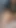Seksi Rumen sahibe kadın egemenliği takma yarakla büyük takma yarakla dildoyla sikişiyor, anal sikiş, yumruk sokma götünü esnetiyor | Klip 1