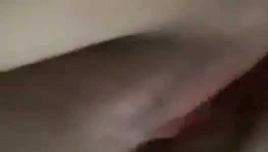 Amputiertes mädchen zeigt ihren körper