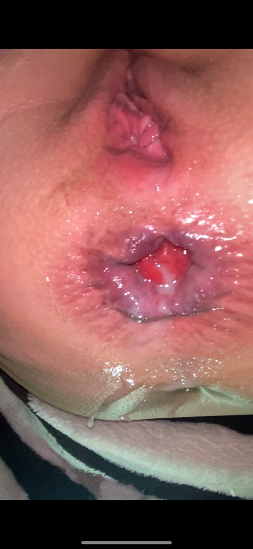 Beauty broken anal of milf can’t stop squirting from anal fuck