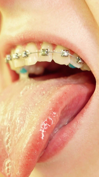 Powerful moment from "braces mouth tour video - vore fetish"