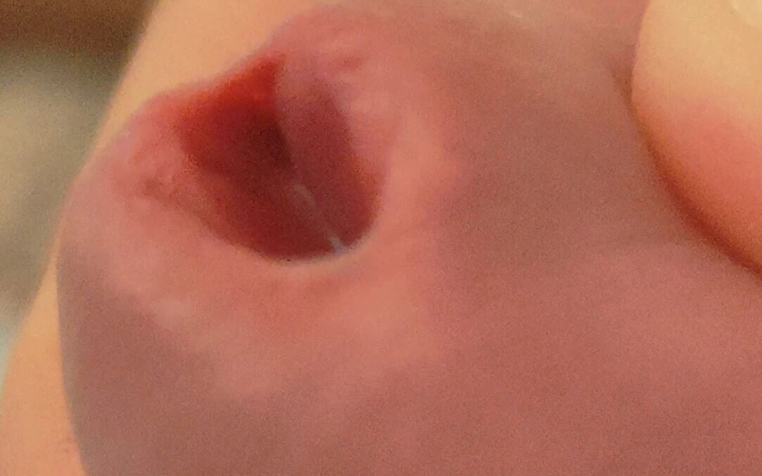 Amazing Closeup of the Widened Hole!!