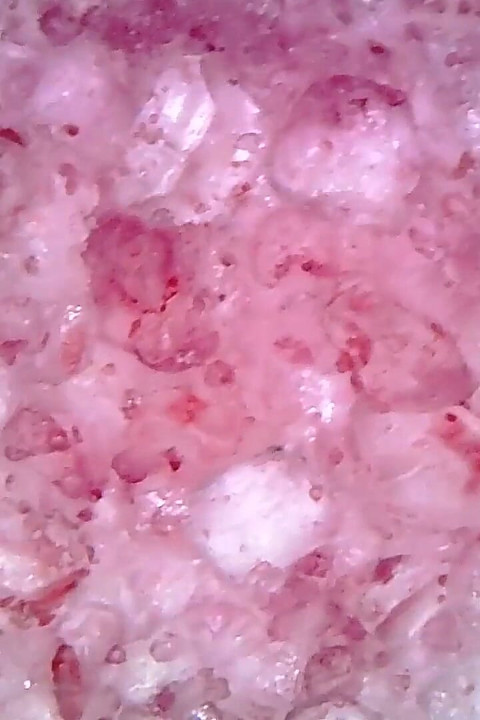 Medical Endoscope Oral Exam: Gummy Chewing, Extreme Teeth & Tongue Macro