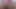 Kitty Bush Skinny Hairy Girl Big Clit and Hairy Arm Pits