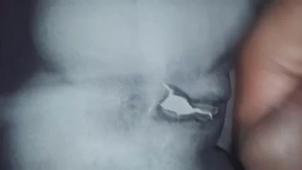 Zoe Dee Video Tribute