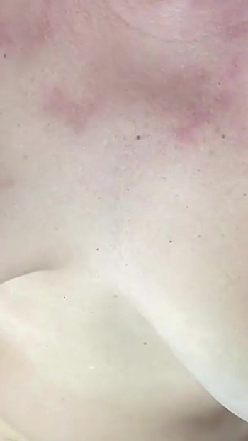 Epic moment from "Chubby Ass destroyed. Close up anal. Anal Gaping. Hairy Pussy. Amateur Anal. MILF Anal. Hairy Asshole"