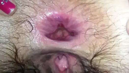 Wife anal fuck with huge gape