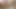 Lizzy Yum January 2023 #30 lizzy douching post op pussy masturbation orgasm