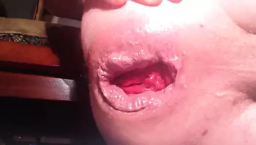 anal insertion prolapse ass gaping huge asshole