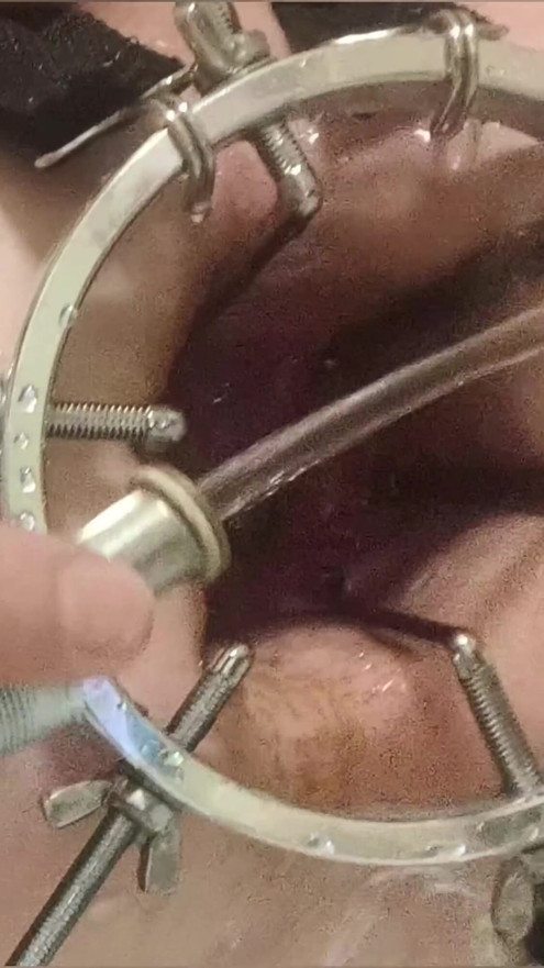Enema, anal shower. Close-up view through anal mirror. Anal with water. Filling anal with water | Clip 2