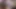 extreme close up of my ugly and dirty cock with castrated testicle PART 2