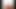 aNAL DILATACION Penetration doggy femenine eyaculation2