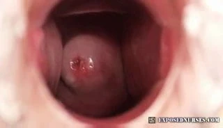 Nurse Zaneta speculum masturbation at clinic