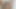 Lizzy Yum VR november 2023 CUM DREAM Post Op Orgasm Pussy Masturbation