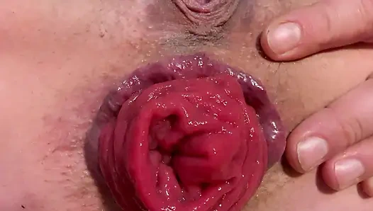 Menyebar dan prolaps lubang pantatku dari dekat