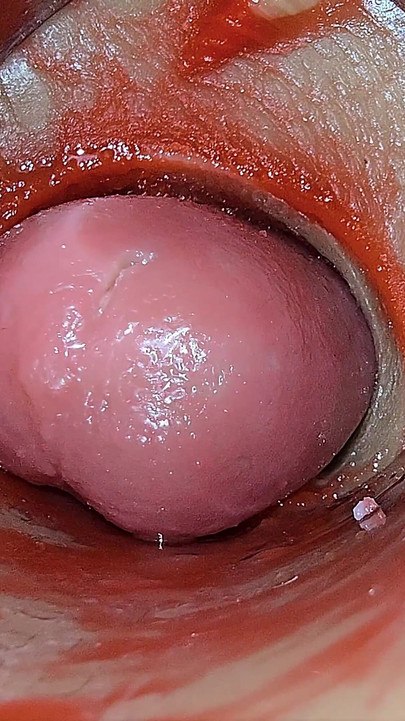 Kamera Unutar Duboke Pičke Snima Predoziranje Ejakulacija Sperme Asmr