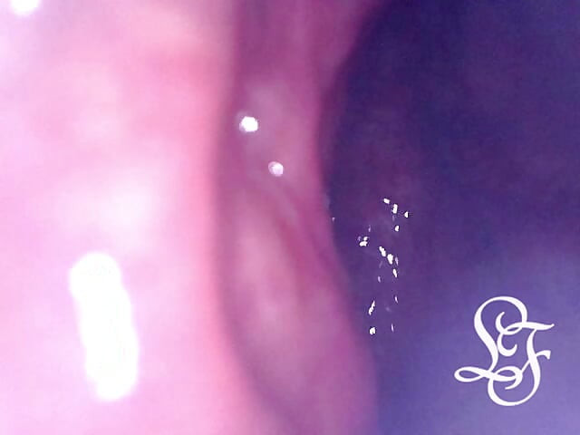 Exploring the Depths of my Ass with the Minicam!
