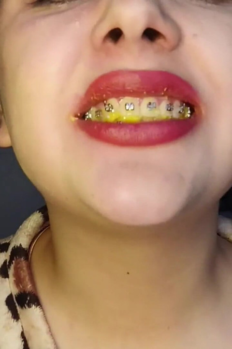 Chew Cheetos Bakış Açısı