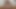 Lizzy Yum SD August 2025 Dilating #84
