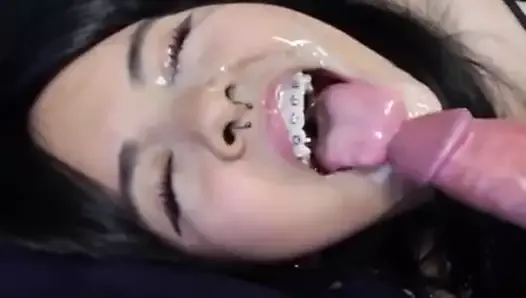 Asian woman with braces takes a facial
